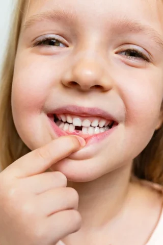 Χαλασμένα Δόντια σε Παιδιά