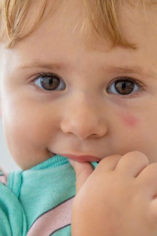 Swollen cheek in a child