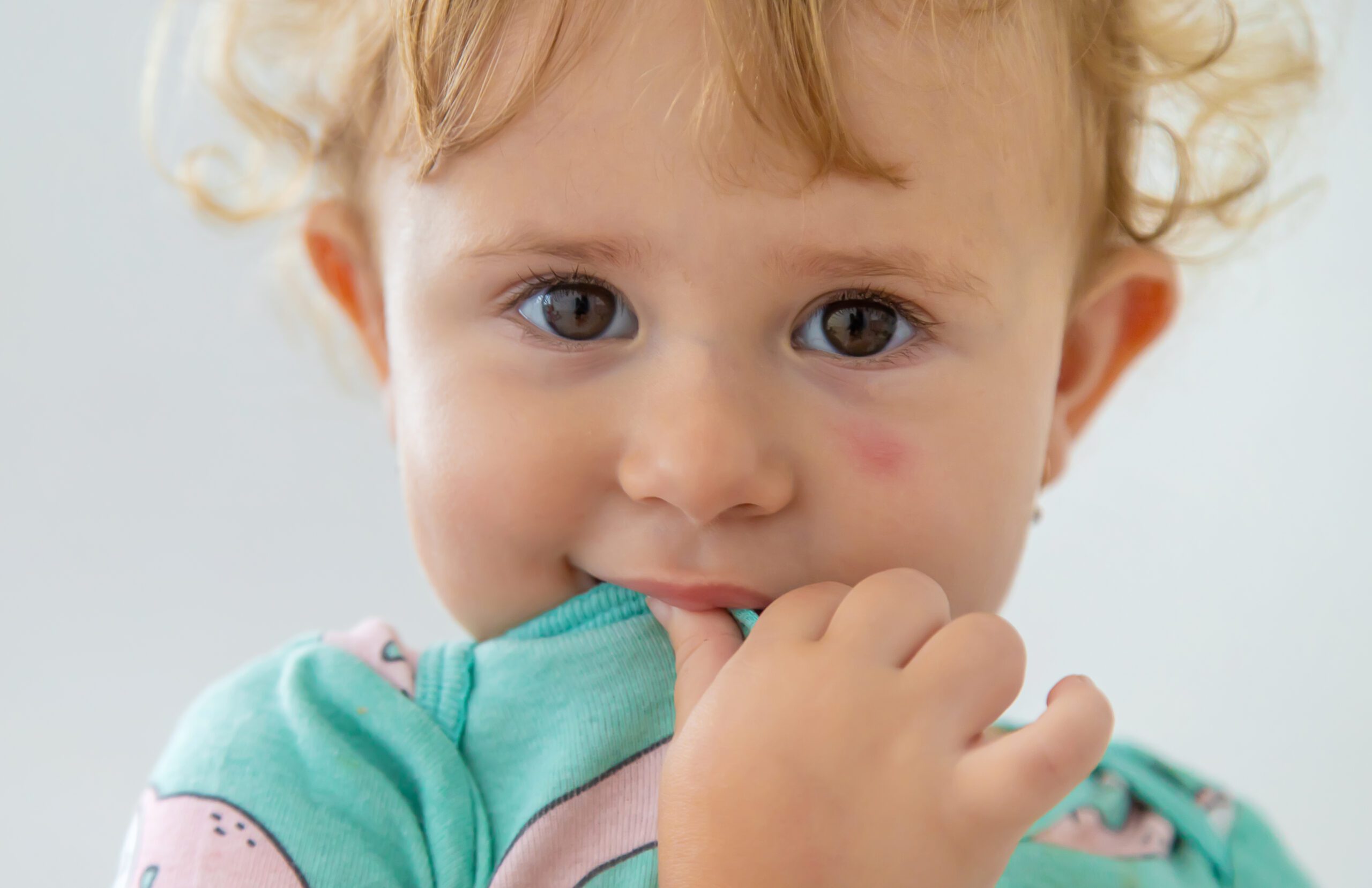 Swollen cheek in a child